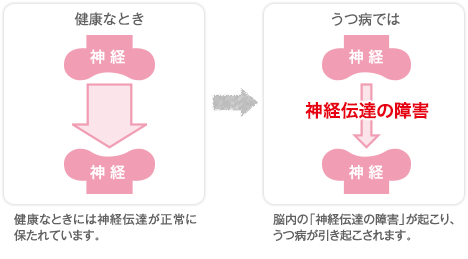 健康な時…健康な時には、脳内の神経伝達物質(セロトニン等)の量が一定に保たれています。うつ病になると…神経伝達物質(セロトニン等)の量が減り、神経伝達がうまくできなくなります。