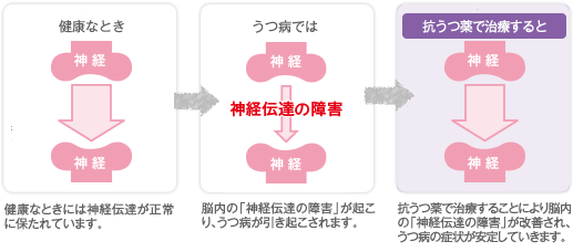 健康な時には、脳内の神経伝達物質(セロトニン等)の量が一定に保たれています。うつ病になると、神経伝達物質(セロトニン等)の量が減り、神経伝達がうまくできなくなります。SSRIやSNRIで治療することによって、神経伝達物質の量が増え、うつの症状が改善していきます。